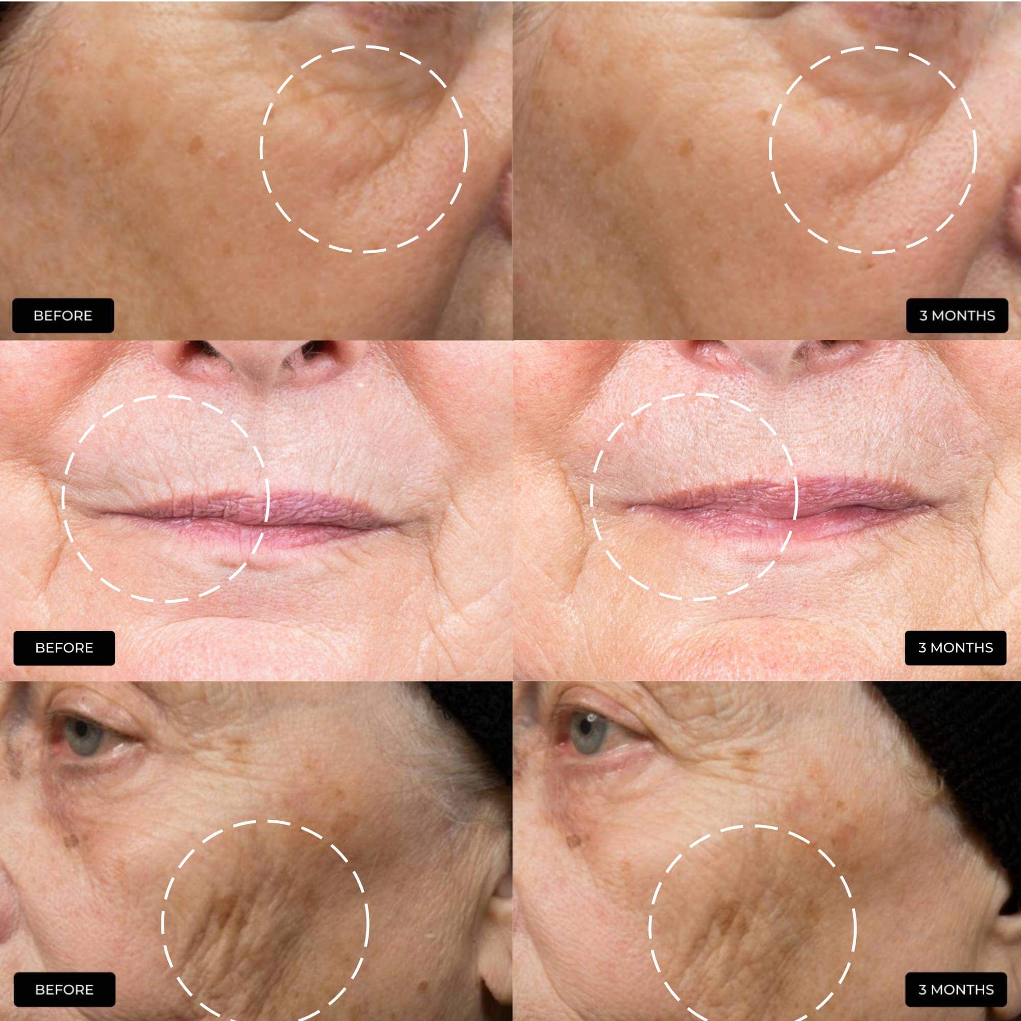 Night Repair Therapy